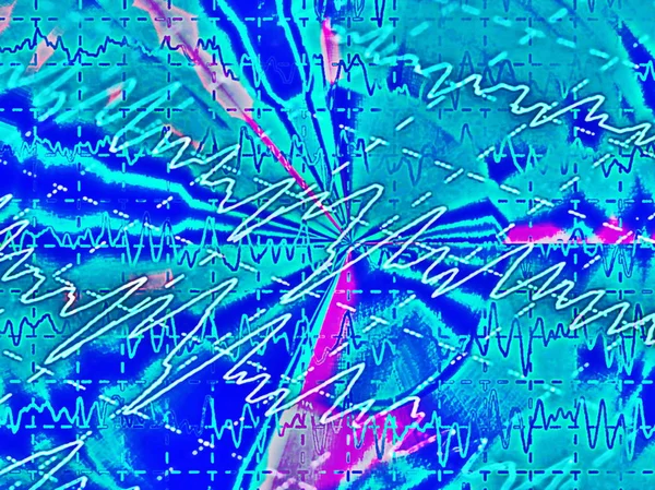 Agyi hullámok a elektroencefalogram, Eeg, epilepszia, illusztráció — Stock Fotó