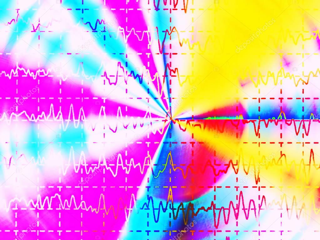 brain wave on electroencephalogram, EEG for epilepsy, illustration
