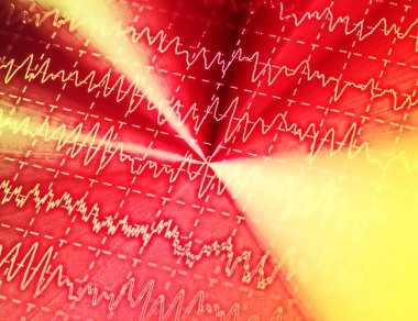 electroencephalogram, epilepsi, illüstrasyon için Eeg beyin dalga