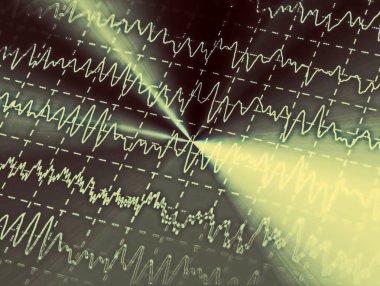 electroencephalogram, epilepsi, illüstrasyon için Eeg beyin dalga