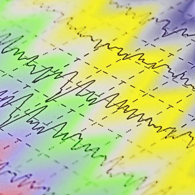 electroencephalogram, epilepsi, illüstrasyon için Eeg beyin dalga