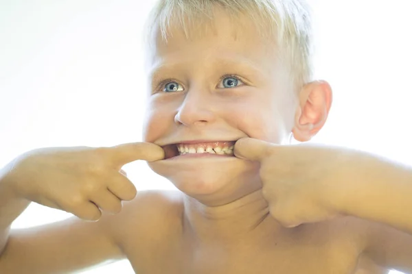 El chico muestra dientes blancos . —  Fotos de Stock