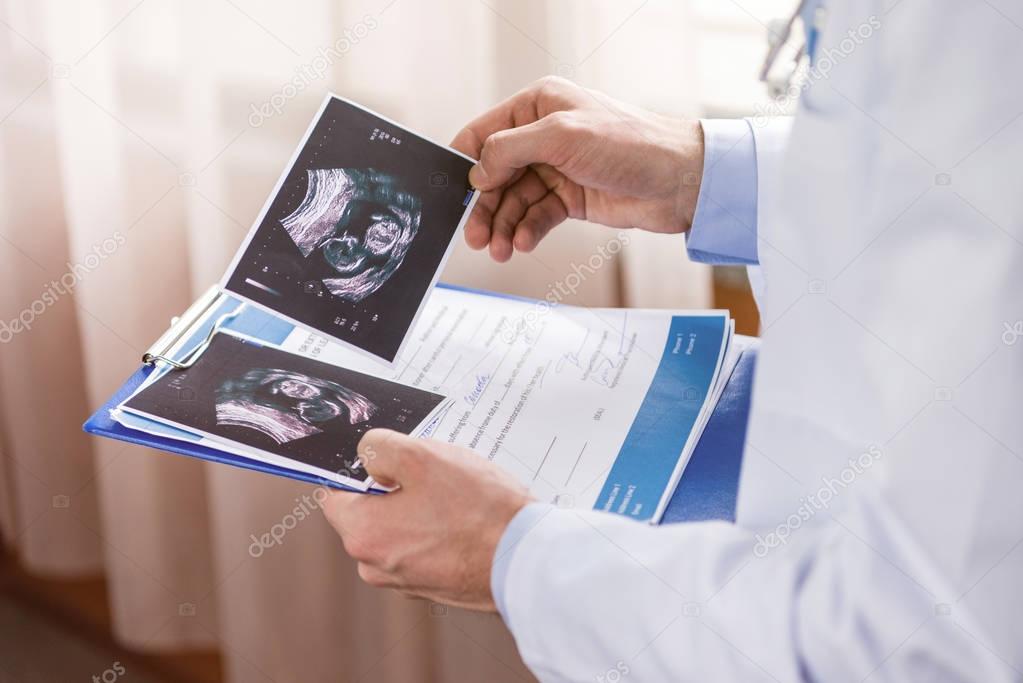 Doctor holding ultrasound scans 