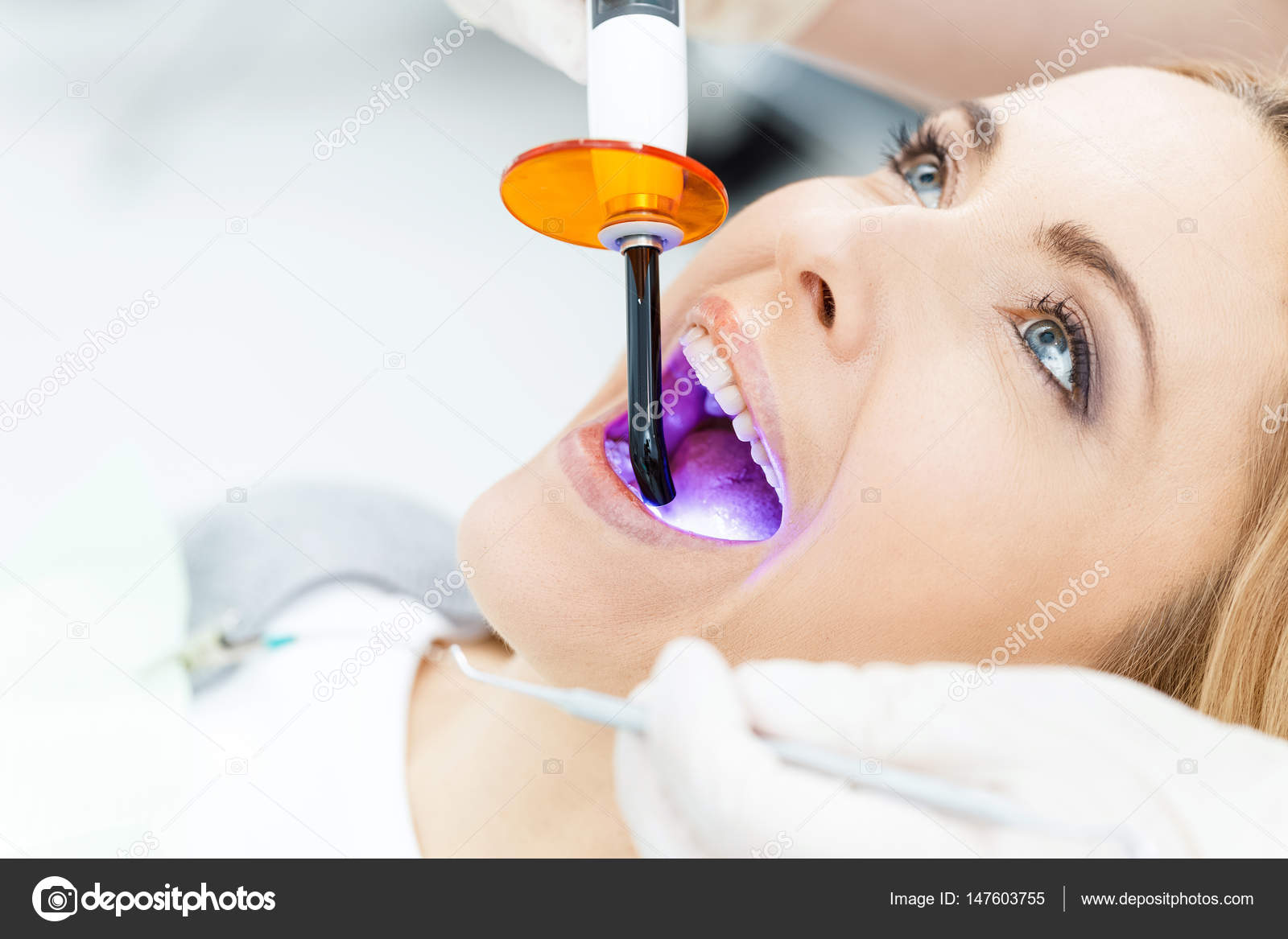 Patient whitening teeth at dentist Stock Photo by ©AndreyBezuglov 147603755