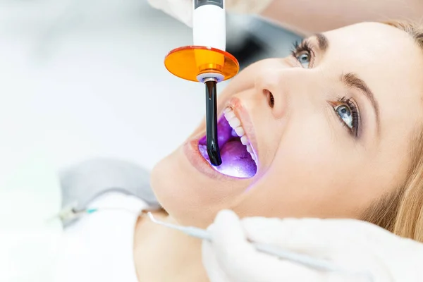 Clareamento dos dentes do paciente no dentista — Fotografia de Stock