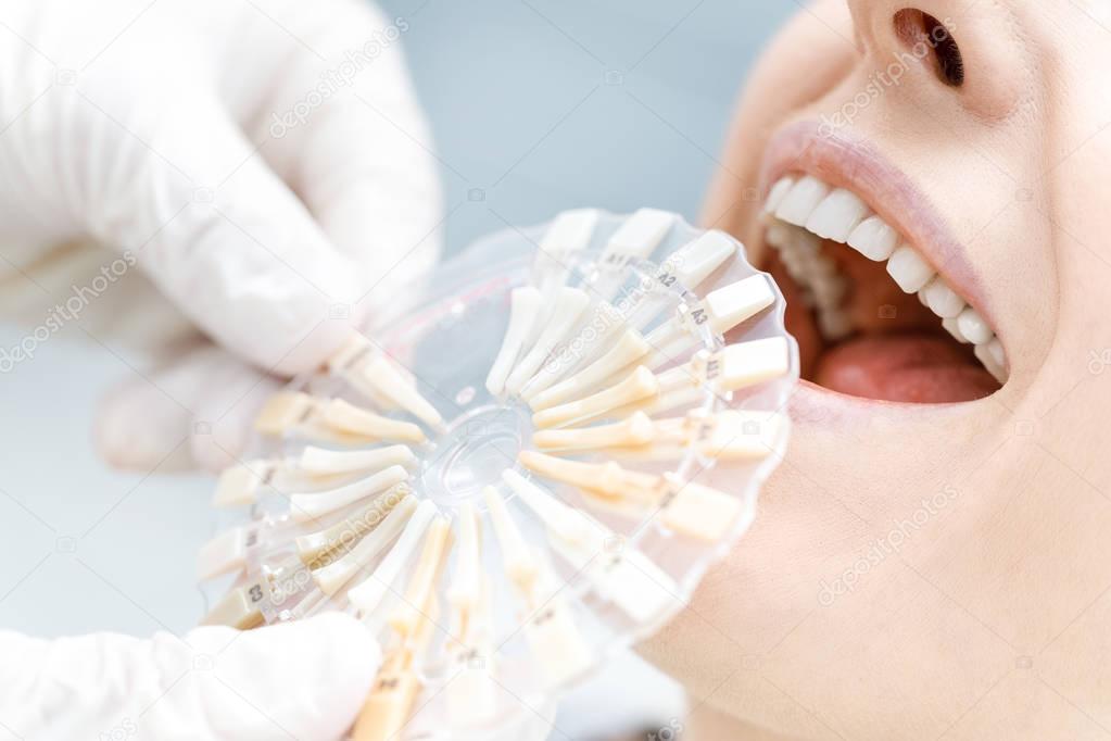 Dentist comparing teeth of patient with samples