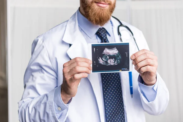 Doctor holding ultrasound scan — Stock Photo