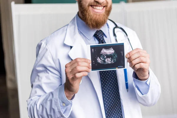 Doctor holding ultrasound scan — Stock Photo