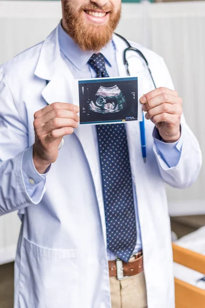 Doctor holding ultrasound scan — Stock Photo