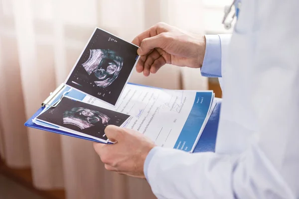 Doctor holding ultrasound scans — Stock Photo