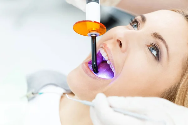 Paciente blanqueamiento de dientes en el dentista - foto de stock