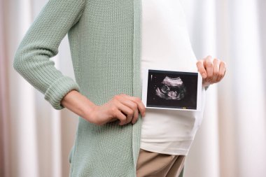Bebeğin ultrason inceden inceye gözden geçirmek ile hamile kadın