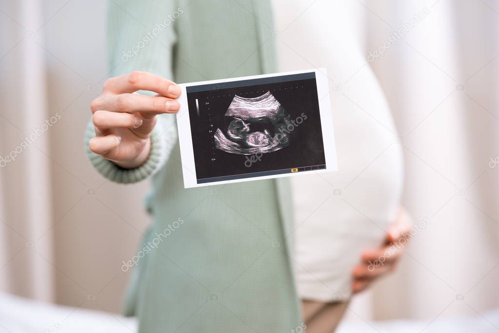 Pregnant woman holding scan of baby 3