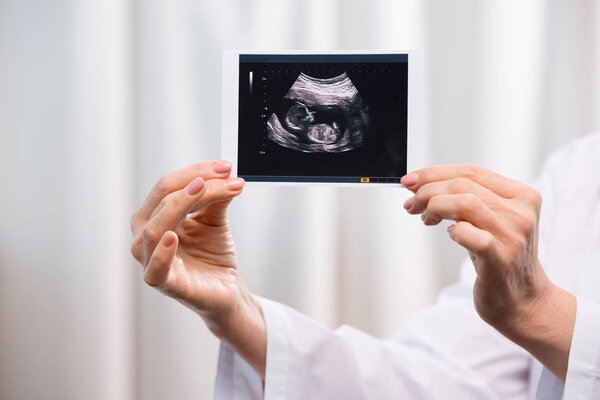 doctor holding scan of baby
