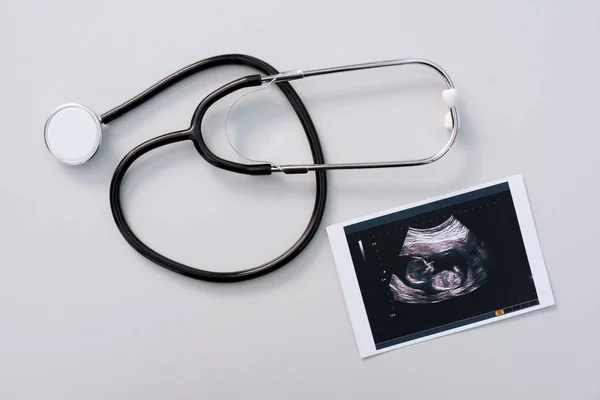 Estetoscópio com resultado da investigação ultrassonográfica — Fotografia de Stock