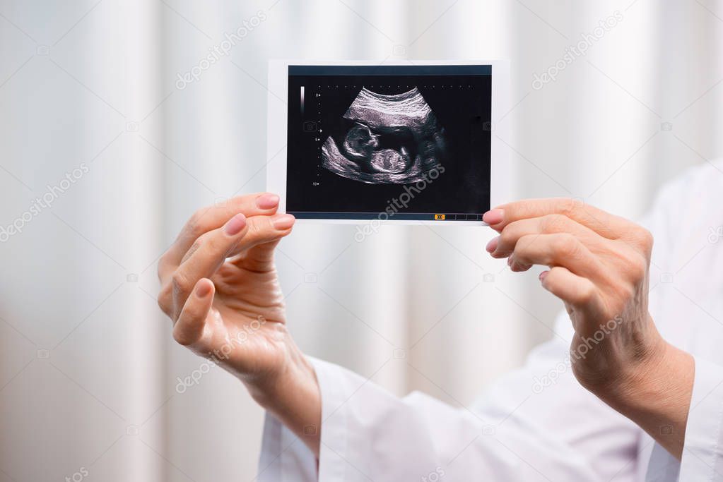 doctor holding scan of baby