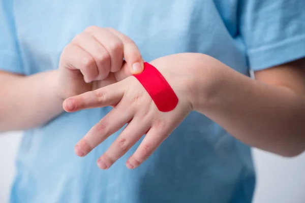 Red patch on hand — Stock Photo