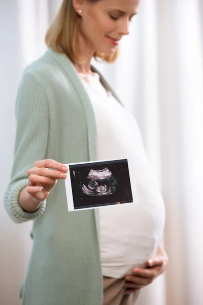 Pregnant woman holding scan of baby — Stock Photo