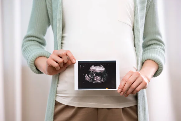 Pregnant woman with ultrasound scan of baby — Stock Photo