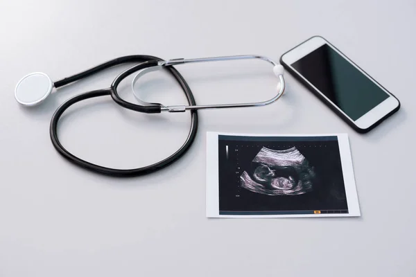 Stethoskop mit Ultraschalluntersuchungsergebnis und Smartphone — Stockfoto