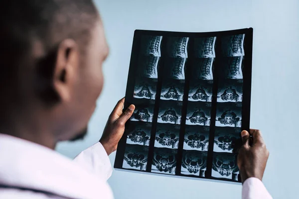 Médico afroamericano con imagen de rayos X - foto de stock