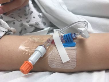 Hastanede kadın kolundaki intravenöz infüzyon için modern periferik Venöz kateter
