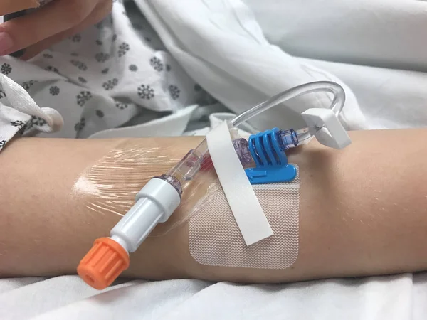 Moderno catéter venoso periférico para perfusión intravenosa en brazo femenino en el hospital — Foto de Stock