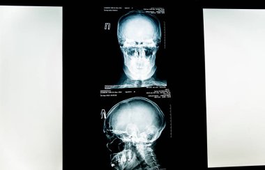 x-ışını resim insan