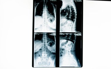 x-ışını resim insan