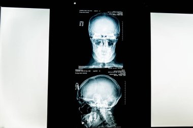 x-ışını resim insan