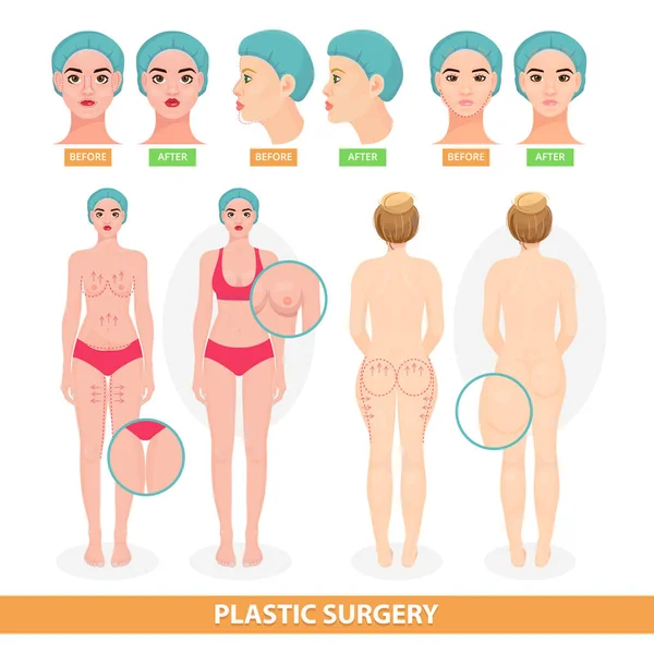 Διάνυσμα πλαστική χειρουργική ασθενής γυναίκα πριν από τη χειρουργική επέμβαση facelifting ή του προσώπου αντι γήρανση ανελκυστήρα χειρουργικά ή μαστού και πρόσωπο επένδυση χειρουργός εικονογράφηση που απομονώνονται σε λευκό φόντο — Διανυσματικό Αρχείο