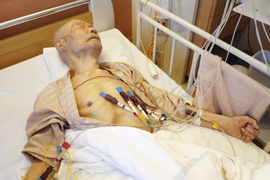 Yatakta yatan yaşlı Japon hasta, hastanede kardiyogram çektir. 