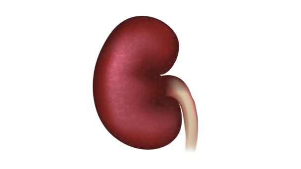 Nefropatia diabética, doença renal — Vídeo de Stock