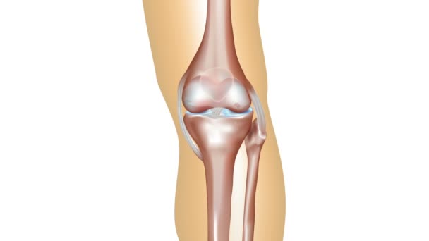 Osteoarthritis formation from normal knee joint anatomy till damaged — Stock Video