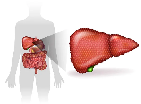 Doença hepática, variedade de doenças podem afetar o fígado — Vetor de Stock