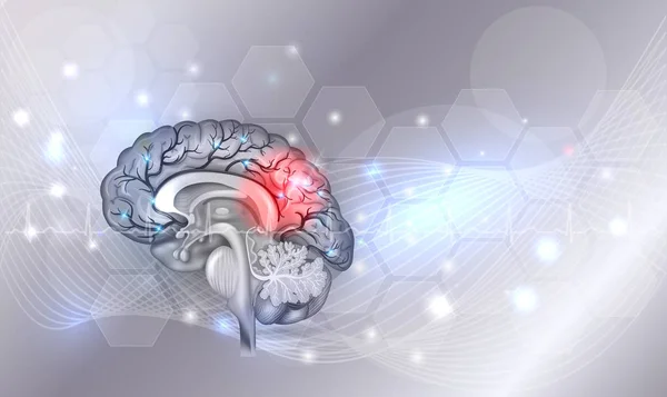 Проблемы мозга человека светло-серый светящийся фон — стоковый вектор