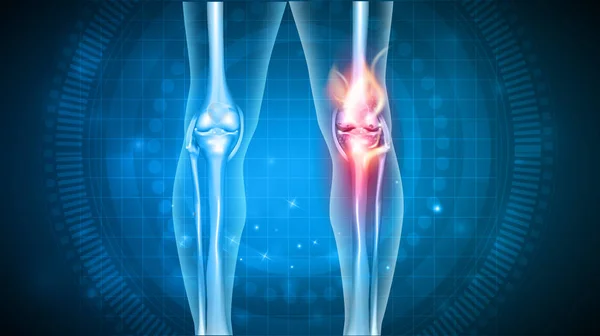 무릎 통증 추상적인 디자인 — 스톡 벡터