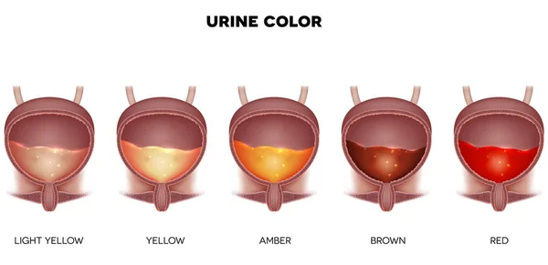 Gráfico de cores da urina — Vetor de Stock