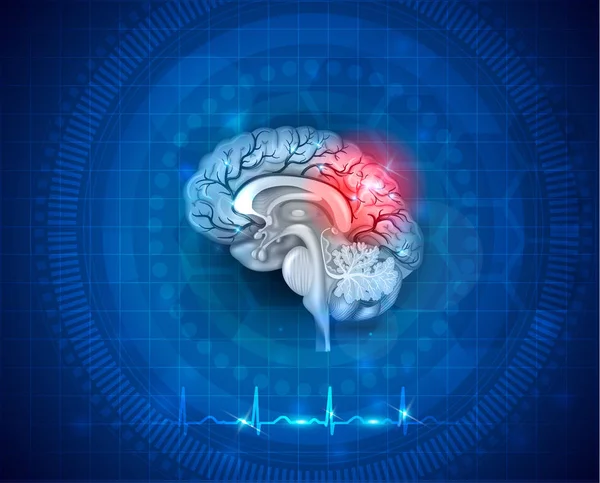 Повреждение и лечение мозга человека — стоковый вектор