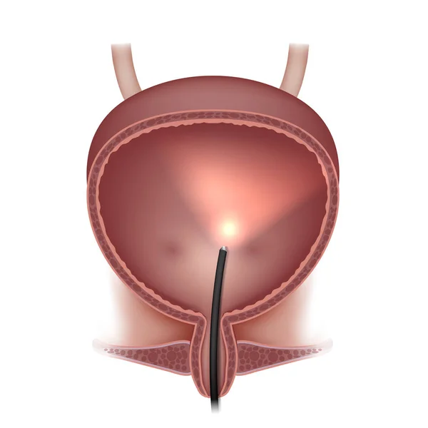 Urineblaas onderzoek — Stockvector