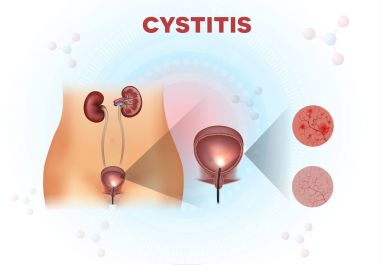 Üriner sistemin anatomisi ve idrar kesesi
