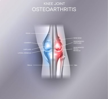 Zarar görmüş ve sağlıklı ortak tasarım