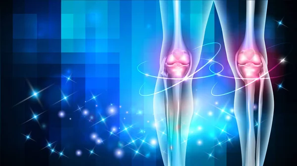 Лечение повреждения суставов — стоковый вектор