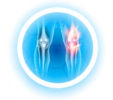 Eklem problemleri sembolü