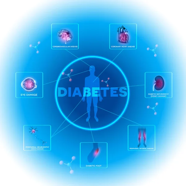 Informação de diabetes —  Vetores de Stock