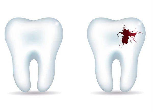 Gezonde tanden en ongezonde tand — Stockvector
