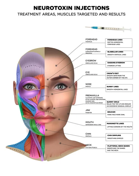 Inyecciones estéticas — Vector de stock