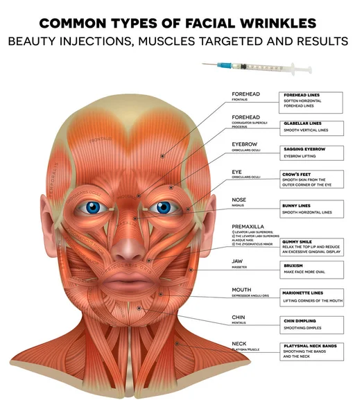 Injeções faciais — Vetor de Stock