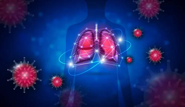 Пневмония Вызванная Осложнением Инфекции Коронавируса Дыхательных Путей Концепция Лечения — стоковый вектор