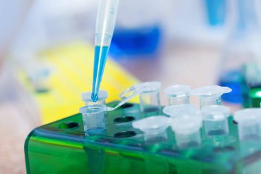 Laboratuar deney deney tüpü